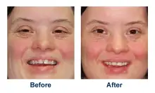 Cosmetic Dentistry Oak Park IL