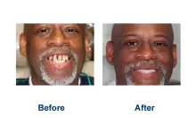 Oak Park IL Dentist