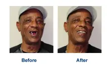 Oak Park IL Dentist